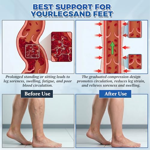 Medical Thigh High Compression Stockings Graduated Compression Socks 4X-Large Black