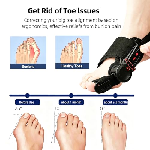 Bunion Corrector for Women & Men, Adjustable Orthopedic Bunions Correction, Breathable Bunion Brace Anti-Slip Bunion Fixer & Straightener Hallux Valgus Pain Relief for Left and Right Feet