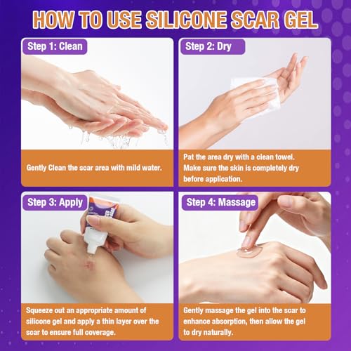 Advanced Scar Gel – Silicone Scar Gel for Keloid Bump Removal, Post-Surgery Scars, Acne Scars, Burn Marks & Stretch Marks – Scar Treatment for Old & New Scars – 1.2oz / 35g 1.2 Ounce (35g)