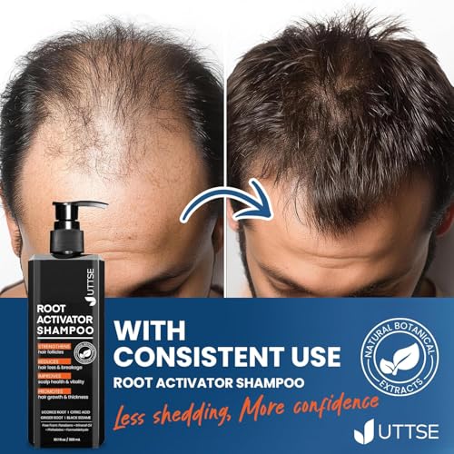 Root Activator Shampoo for Men: Hair Growth Shampoo for Men's Thinning Hair and Hair Loss - Men's Scalp Care - 10.1 fl oz / 300 mL Natural 10.1 Count (Pack of 1)