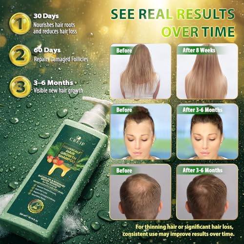 Rosemary & Batana Oil Hair Growth Shampoo: Hair Loss Shampoo for Men and Women with Biotin, Sulfate & Fragrance-Free Thickening Wild Lavender 10 Count (Pack of 1)