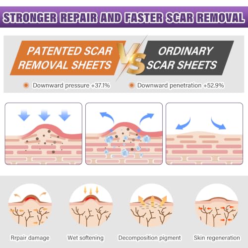 Silicone Scar Sheets, Medical Grade Silicone Scar Tape for Surgical, Hypertrophic, Keloid, C-Section, Burn, Old & New Scars, Reusable Professional Scars Removal Sheets (1.6"X 55" Roll-1.4M)