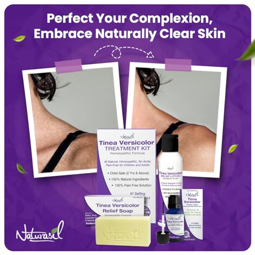 Naturasil Tinea Versicolor Treatment 2-Step Kit with Lotion & Sulfur Soap Tinea Lotion + Soap