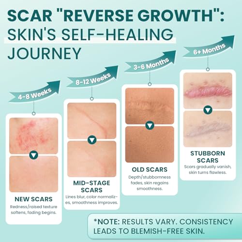 Scar Cream Gel Silicone Removal for Surgical Scars Burn Old Scars Acne Face Stretch Marks Hypertrophic Keloid wait Silicone Gel For Scars Topical Remover 2Pack 1.7 Oz