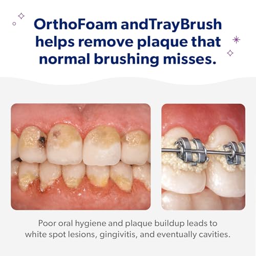 EverSmile Braces Care Bundle for Kids: OrthoFoam (50ml) + TrayBrush U-Shaped Toothbrush – Deeply Cleans All Your Teeth & Gums at Once, Even Under Metal & Ceramic Braces, Brackets & Wires Child