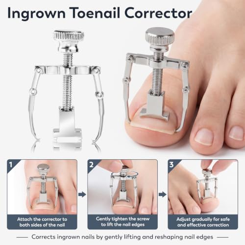 JTIEO 10 Pcs Ingrown Toenail Treatment Kit, Stainless Steel Nail Tools. 10pack-black