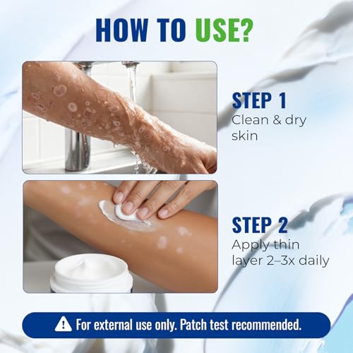 CHARMPOO Advanced Antifungal Cream for Jock Itch & Athlete’s Foot, 3.4 oz single pack