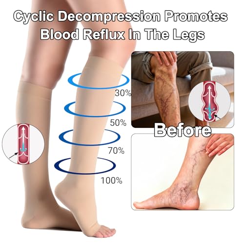 2 Pairs 20-30 mmHg Graduated Compression Socks for Women & Men, Open Toe Knee High stocking, Support Circulation, Travel & Daily Comfort Medium 20-30mmHg Beige 2Pairs
