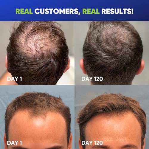 Svvimer Hair Growth Shampoo for Men - Biotin Thickening Shampoo with Rosemary Tea Tree Oil Caffeine for Hair Loss and Thinning - 13.5 Fl Oz (Pack of 1) 13.5 Count (Pack of 1)