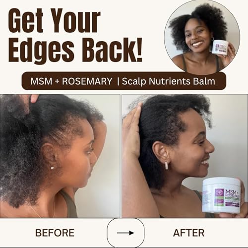 Qhemet Biologics MSM + Rosemary Scalp Nutrients Balm | Food for Hair Growth | MSM, Rosemary, Bhringraj, Castor Oil & Coconut Oil | For Dry Scalp, Thinning & Slow Growth | Vegan (4 oz)