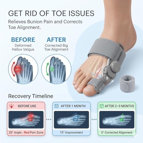Bunion Corrector for Women & Men, Adjustable Hallux Valgus Splint with Silicone Gel Pad, Big Toe Separator & Alignment Brace, Anti-Slip Heel Strap, Bunion Support for Day & Night Wear
