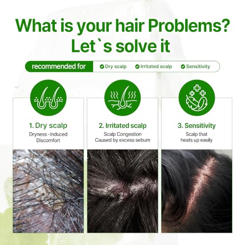 SOME BY MI Cica Peptide Anti Hair Loss Derma Scalp Serum 2.7 fl oz– No Wash Scalp Treatment for Thinning Hair & Sensitive Scalp – Soothing, Hydrating Hair Growth Care Korean Haircare