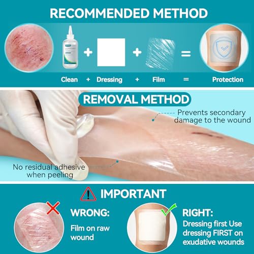 Dimora Waterproof Transparent Film Dressing, Clear Bandage Tape for Wound Care, Adhesive Post Surgical Cover Pad，for IV Shield, Tattoo Aftercare, Shower Protector 4x4 3/4 inch 100 Packs 4"x 4.75"(100 PCS)