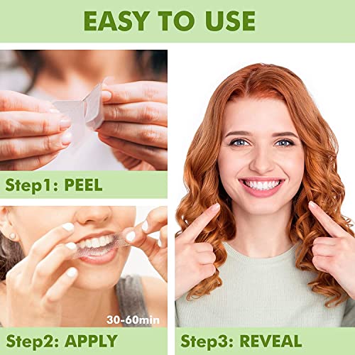 Sierra Teeth Whitening Strips 14 Treatments 28 Strips, Sensitivity Free Enamel Safe, Fast Teeth Whitening Kit, Dentist Recommended Remove Coffee Tea Smoking Stains (Coconut Mint)