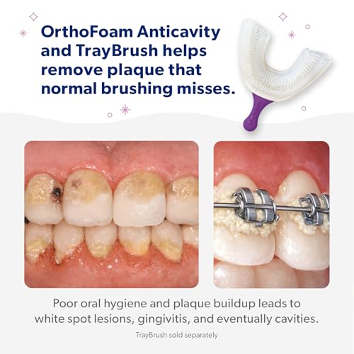 EverSmile OrthoFoam Anticavity Braces Cleaner w/Fluoride — 60 Uses Per 50ml Bottle – Helps Strengthen Enamel & Protect Against Cavities – Foam Cleans Under Metal & Ceramic Braces – 2 Pack, Bubble Gum