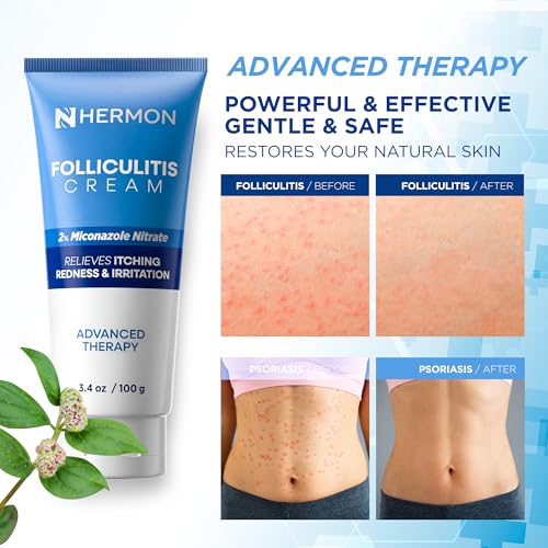 Hermon Folliculitis Cream: Effective for Folliculitis Scalp Face and Body 100g 3.4 Ounce(Pack of 1)