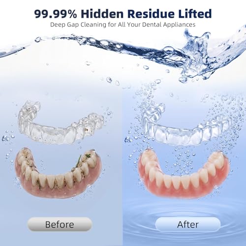 Ultrasonic Retainer Cleaner Machine for Dentures Aligners Mouth Guards BLack