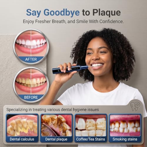 Plaque Remover for Teeth, Dental Cleaning Kit Tartar Remover for Teeth with LED Light & 5 Modes, Rechargeable Dental Cleaner, 3 Replaceable Heads