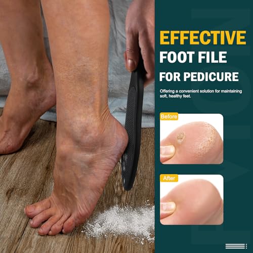 FVION Double-Sided Nano Glass Foot File for Callus Remover - Highly Effective Hard and Dead Skin Remover for Cracked Heels and Dry Skin (Black) Black