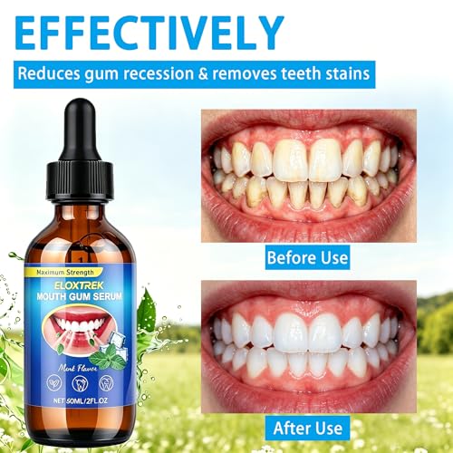 2Pcs Gum Restore Drops 2 Fl Oz - Advanced Repair for Receding Gums, Stain Removal & Dry Mouth - Bad Breath Treatment Natural Mint Breath Freshener with Olive Oil Tea Tree Oil 2 Fl Oz (Pack of 2)