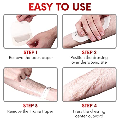 Transparent Film Dressing 4" x 4.75" (10 Pack) - Waterproof Adhesive Wound Bandages for Post-Surgical Shower, IV Shield, Tattoo Aftercare, Clear Breathable Dressing Patches by HEALQU 4"x4.7" (10 Pack)