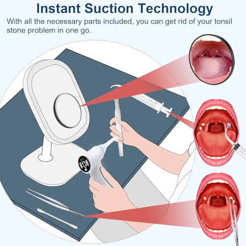 Tonsil Stone Remover Tool with 6-Level Suction for Bad Breath Prevention Dental Care Set – 3Pcs Tartar Scrapers, Plaque Remover & Mirror, 304 Stainless Steel Teeth Cleaning Tools (Black) Black