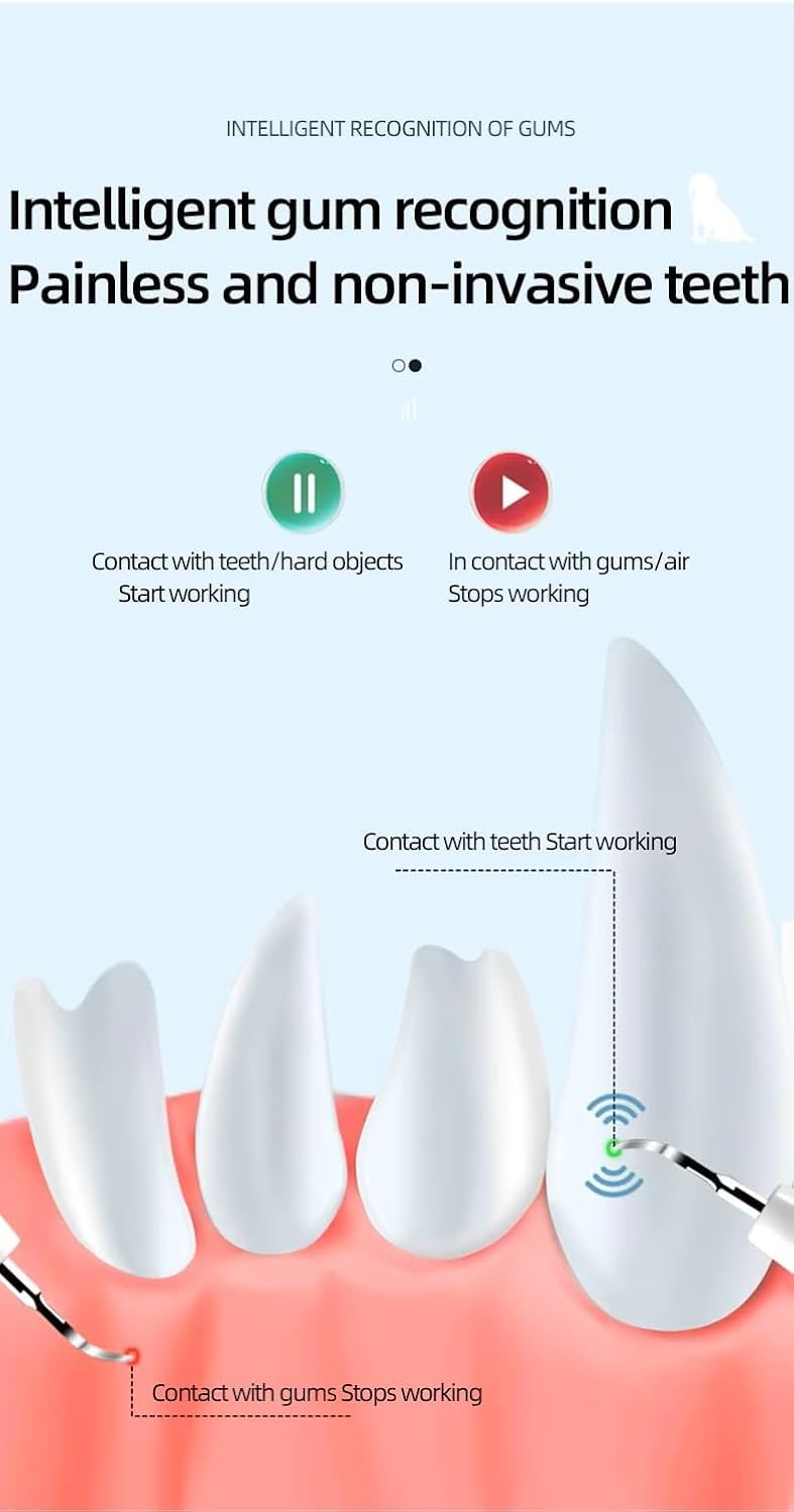 Dog Teeth Cleaning Kit | Pet Tooth Cleaner | Dental Care Tartar Plaque Remover for Dogs and Cats