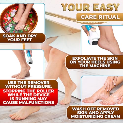 Battery Operated Foot Callus Remover for Dead Skin, Exfoliating Tool Ocean Blue Callus Remover