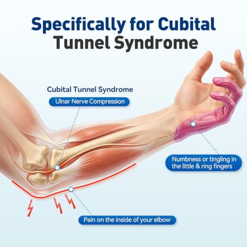 Elbow Brace for Cubital Tunnel & Ulnar Nerve – Night Splint for Sleep, M