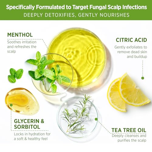 Roycederm Tea Tree Scalp Scrub with Scalp Massager Brush – Deep Cleansing & Exfoliating Pre-Shampoo Treatment for Dry, Flaky Scalp – Gently Refreshes, Hydrates & Balances Scalp