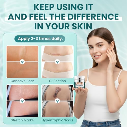Scar Cream Gel Silicone Removal for Surgical Scars Burn Old Scars Acne Face Stretch Marks Hypertrophic Keloid wait Silicone Gel For Scars Topical Remover 2Pack 1.7 Oz