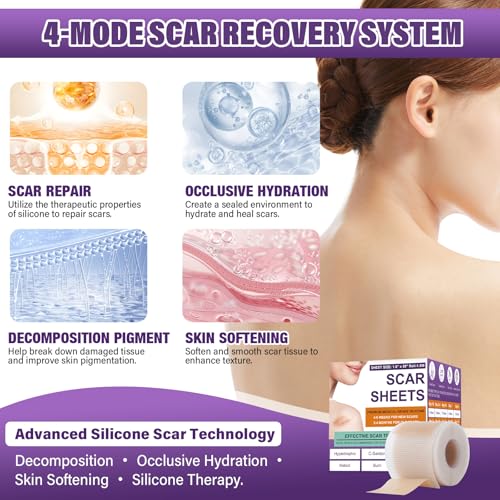 Silicone Scar Sheets, Medical Grade Silicone Scar Tape for Surgical, Hypertrophic, Keloid, C-Section, Burn, Old & New Scars, Reusable Professional Scars Removal Sheets (1.6"X 55" Roll-1.4M)