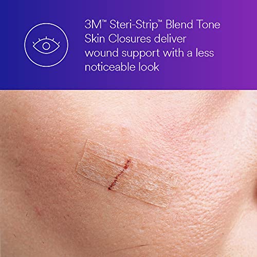 3M™ Steri-Strip™ Blend Tone Skin Closures, B1557, Tan, 1/2 in x 4 in (12mm x 100mm), 50 Bag/Carton, 4 Carton/Case