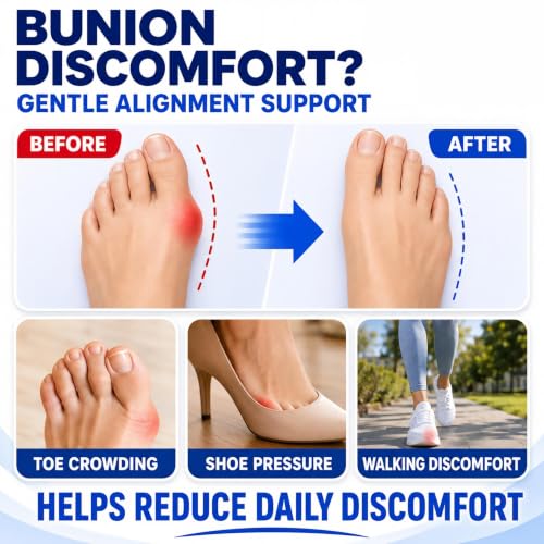 Bunion Corrector for Women & Men, All-in-One Bunion Fix Kit with Toe Separator, Arch Support & Hot Cold Gel Pad, Adjustable Bunion Splint Big Toe Straightener for Hallux Valgus Relief Day Night Use (1) 1