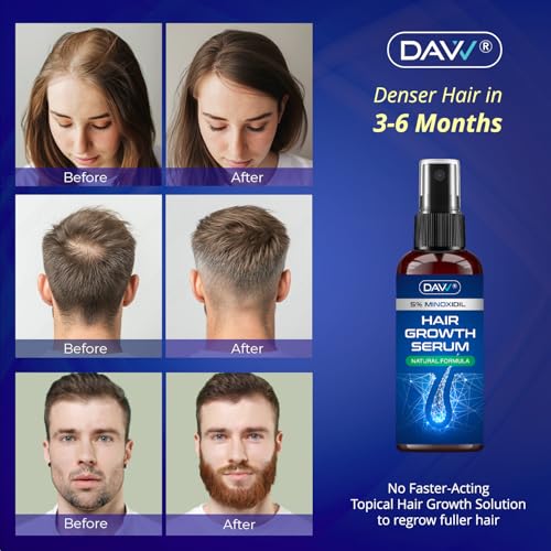 5% Minoxidil Spray for Women Hair Growth: Minoxidil for Men - Extra Strength Hair Regrowth Treatment – Hair Growth - Revitalize Hair Follicles - Regrow Thicker Fuller Hair – Hair Loss Solution - 2Pack 2 Count (Pack of 2)