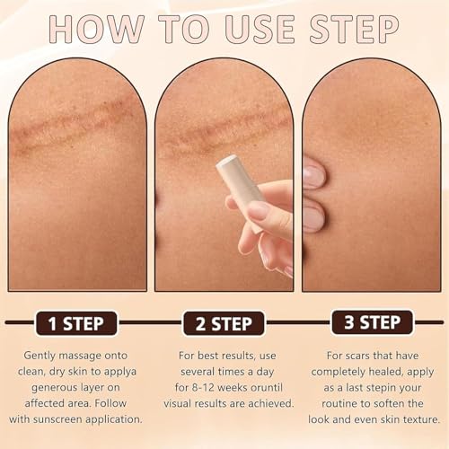 Silicone Scar Stick, Silicone Stick for Face and Body 1Pc
