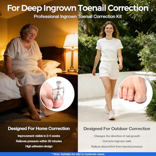 Glamonade Ingrown Toenail Removal Kit: Complete Ingrown Toenail Tool With Corrector Patch And Relief Softening Drops For Soothing Comfort, At‑Home Professional Kit For Men & Women with Curved Toenails 13 Pcs