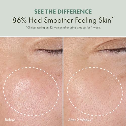 Origins Checks and Balances Daily Exfoliating Toner | Cleanses Skin & Gently Exfoliates | Witch Hazel Toner with Hyaluronic Acid | Alcohol-Free, 5 Fl Oz