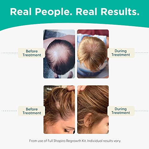 Shapiro MD Hair Growth Experts Hair Loss Leave-in Conditioner, DHT Fighting