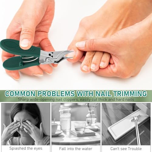 Ingrown Nail Clipper Set,Toenail Clippers for Thick Toenail for Ingrown Toenail Removal Correction Clippers(Green)