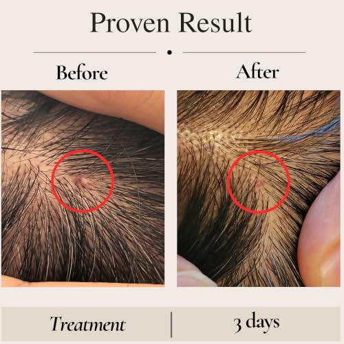 HUNYULE Microbiome-Friendly Scalp Serum, 2 oz – Leave-In Serum for Itchy, Dry & Sensitive Scalp, Supports Fuller-Looking Hair
