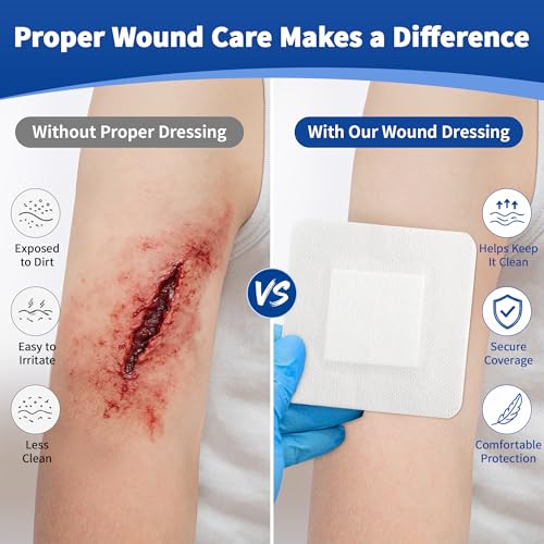 Emergency Wound Closure Strips Kit, 3 Types Butterfly Bandages, Laceration Closure Kit with Cleaning Wipes, Stitchless Wound Closures Device for First Aid (Mix 52Pack) Mix 52Pack