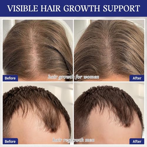 GHK-Cu Copper Peptide Hair Growth Serum for Thinning Hair, Men & Women