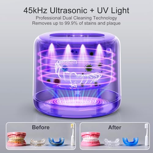 Ultrasonic Retainer Cleaner Machine,45kHz Denture Cleaner White