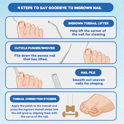 Ingrown Toenail Corrector Kit - Professional Home Pedicure Care for Toenail - Includes Toenail Correction Strips for Ingrown Toenail Relief Removal