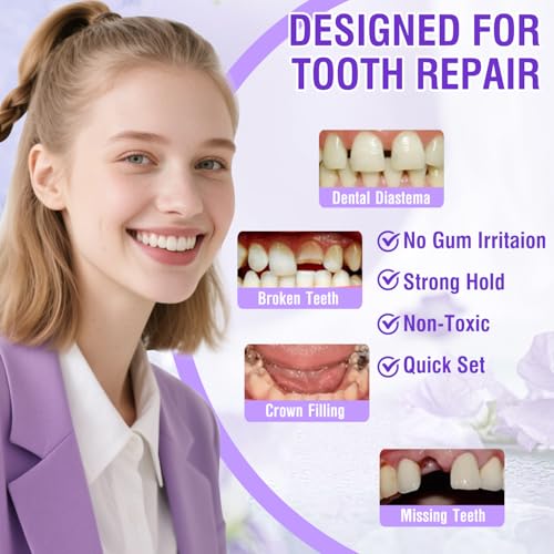 Tooth Repair Kit for Broken Teeth, Dental Cement Temporary Filling Zinc Oxide Eugenol Glue for Chipped Missing Teeth,Crowns & Bridges White