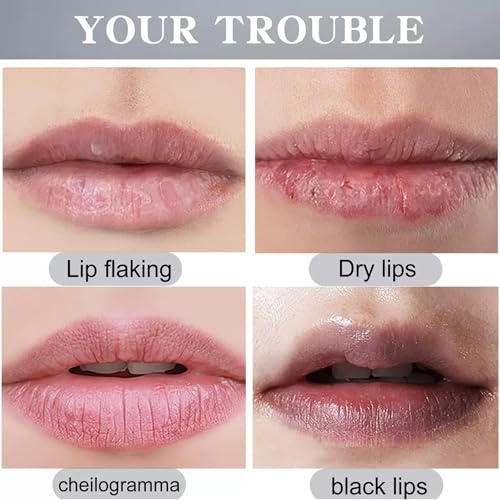 2PCS Turmeric Lip Scrub for Dark Lips, Lip Balm Moisturizer for Smokers, Lip Exfoliator Scrub for Lip Softening and Hydration, Dark Lips Corrector Balm, Reduce Fine Lip Lines, Nourish lips