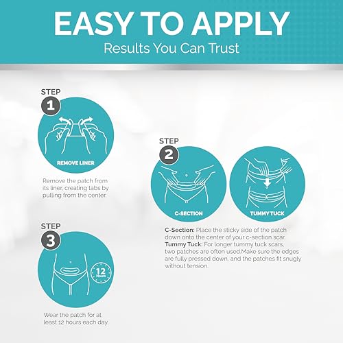 Fade Away Silicone Scar Sheets for C-Section and Tummy Tuck, 8 Count
