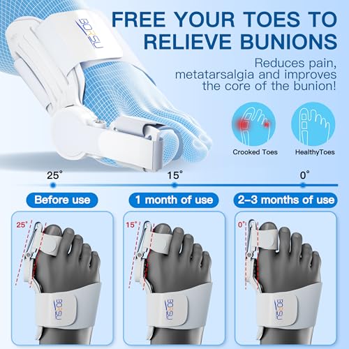 Bunion Corrector For Women Men Big Toe Adjustable Bunion Relief Big Toe Straightener Hallux Valgus Corrector Bunion Splint Brace Effective Pain Relief Day Night Use
