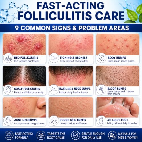 Folliculitis Treatment Cream - 5% Benzoyl Peroxide Treatment for Scalp, Body & Back Bumps, Fast-Acting Relief Ointment for Itching, Redness & Acne, with Centella & Ceramides, Sensitive Skin, 3.53 oz